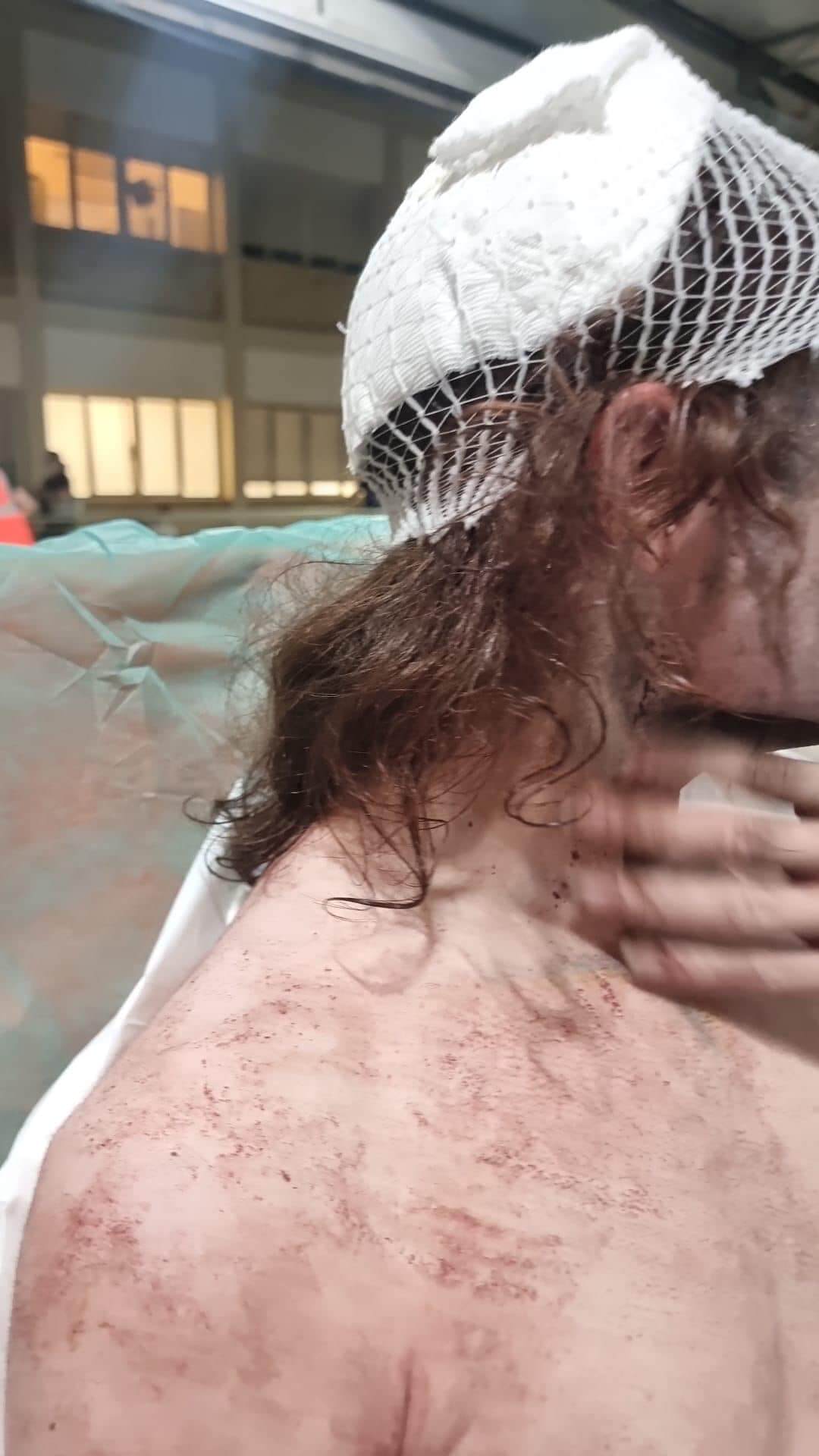 bari aggressione a ragazz non binar