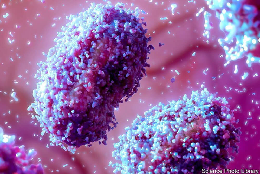 monkeypox vaiolo delle scimmie cose da sapere infettivologo