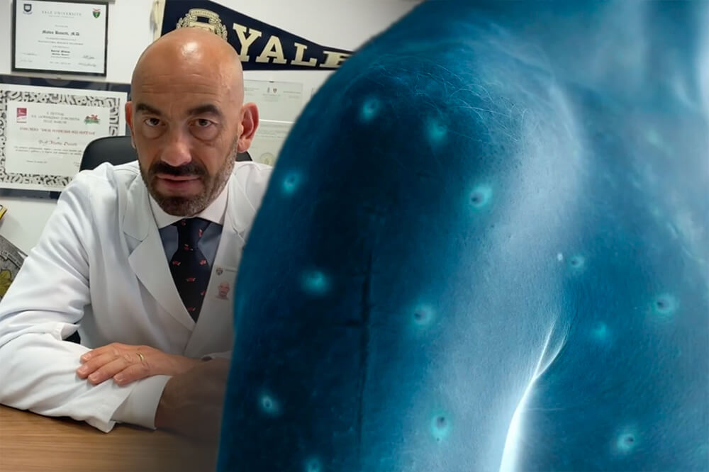 Monkeypox e comunità gay, Bassetti: “Bisogna intervenire, sbagliato chiamarlo vaiolo delle scimmie”