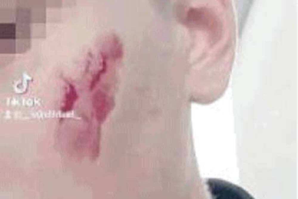 Ragazzo trans di 17 anni aggredito: “Ero abituato agli insulti, ma non erano mai arrivati a tanto”