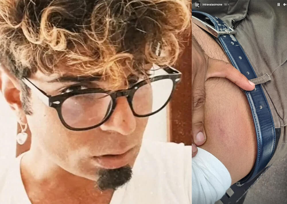 Omofobia a Palermo, insulti e pestaggio dopo il Pride: “Fai schifo. Esci dal locale, sei nudo”