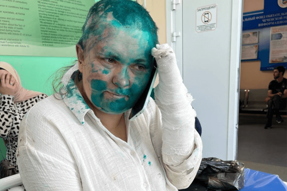 Cecenia, indagava su persecuzioni gay, picchiata la giornalista Elena Milashina