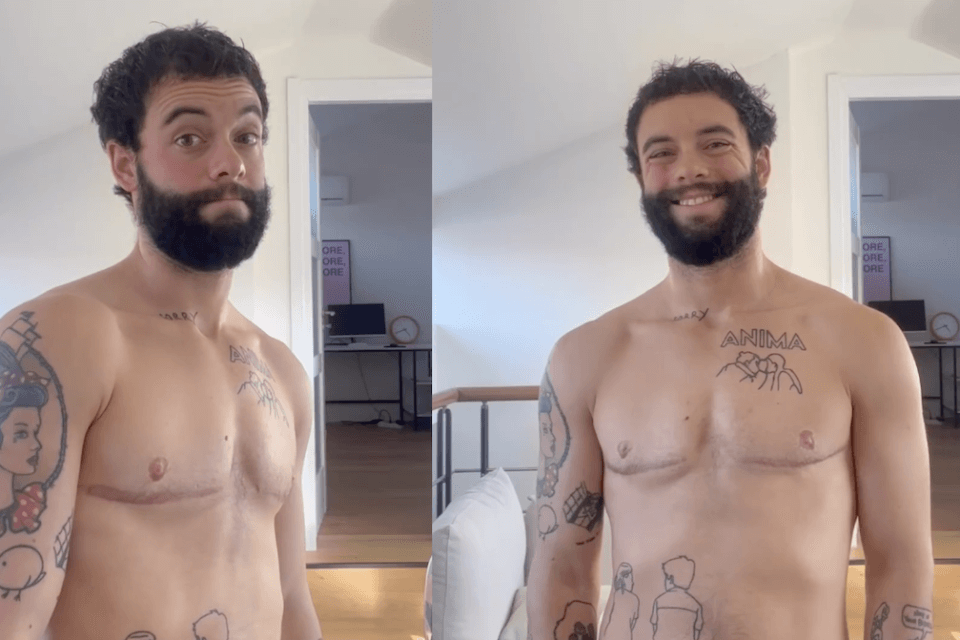 Francesco Cicconetti festeggia i due anni di top surgery: "Sono felicissimo e amo il mio corpo più che mai" - VIDEO - Francesco Cicconetti aka Meths - Gay.it