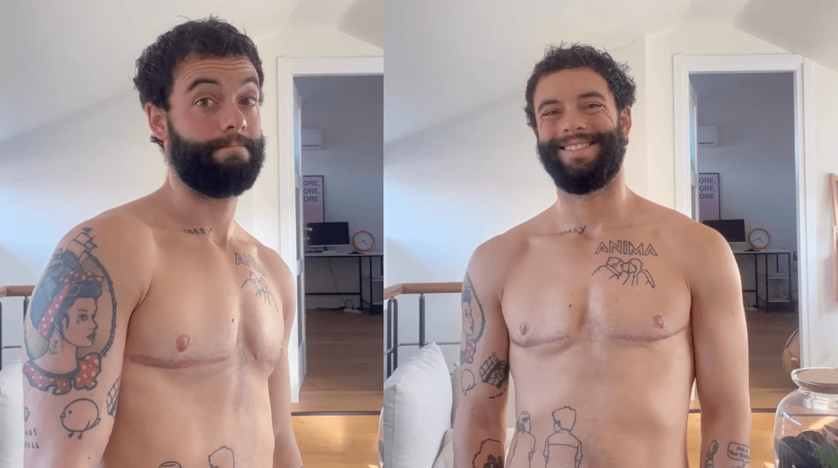 Francesco Cicconetti festeggia i due anni di top surgery: “Sono felicissimo e amo il mio corpo più che mai” – VIDEO