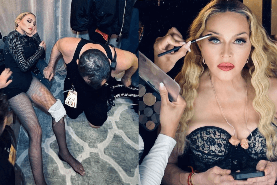 Madonna, le prove del Celebration Tour preoccupano i fan. Le foto social - Madonna ginocchio - Gay.it