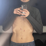 Giancarlo Commare - Thumbnail
