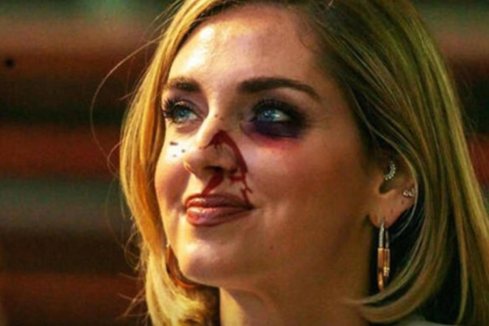 Il volto martoriato di Chiara Ferragni in un violento post Instagram