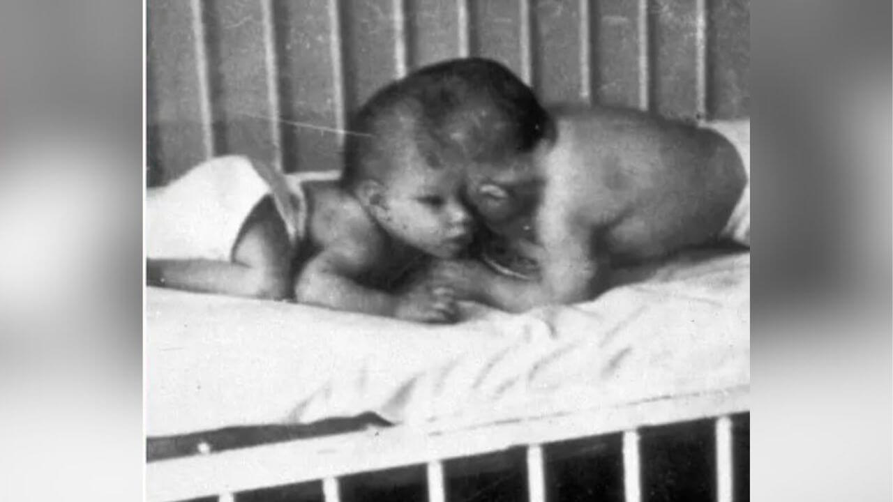 george-lori-schappel-siamesi-morte