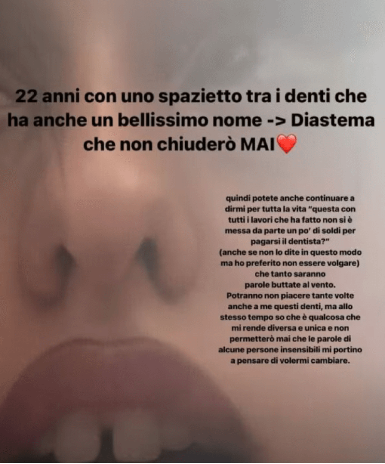 Giulia Stabile denti
