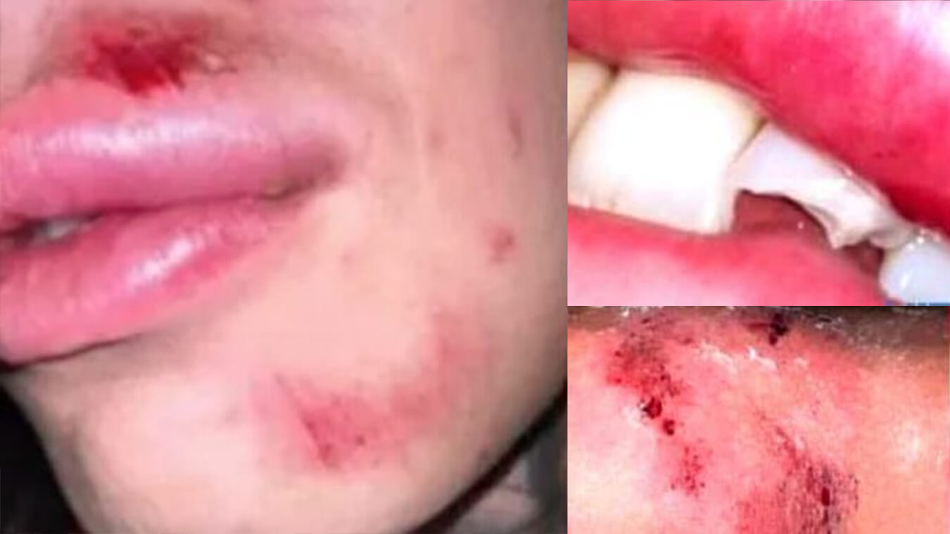 Alessia Giulia ragazze trans aggredite Castiglione in Teverina Viterbo