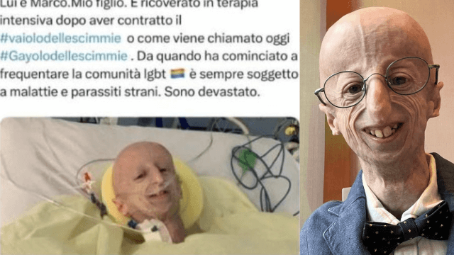 Sammy Basso, una sua foto utilizzata per diffondere fake news omofobe sul MPox - Sammy Basso - Gay.it