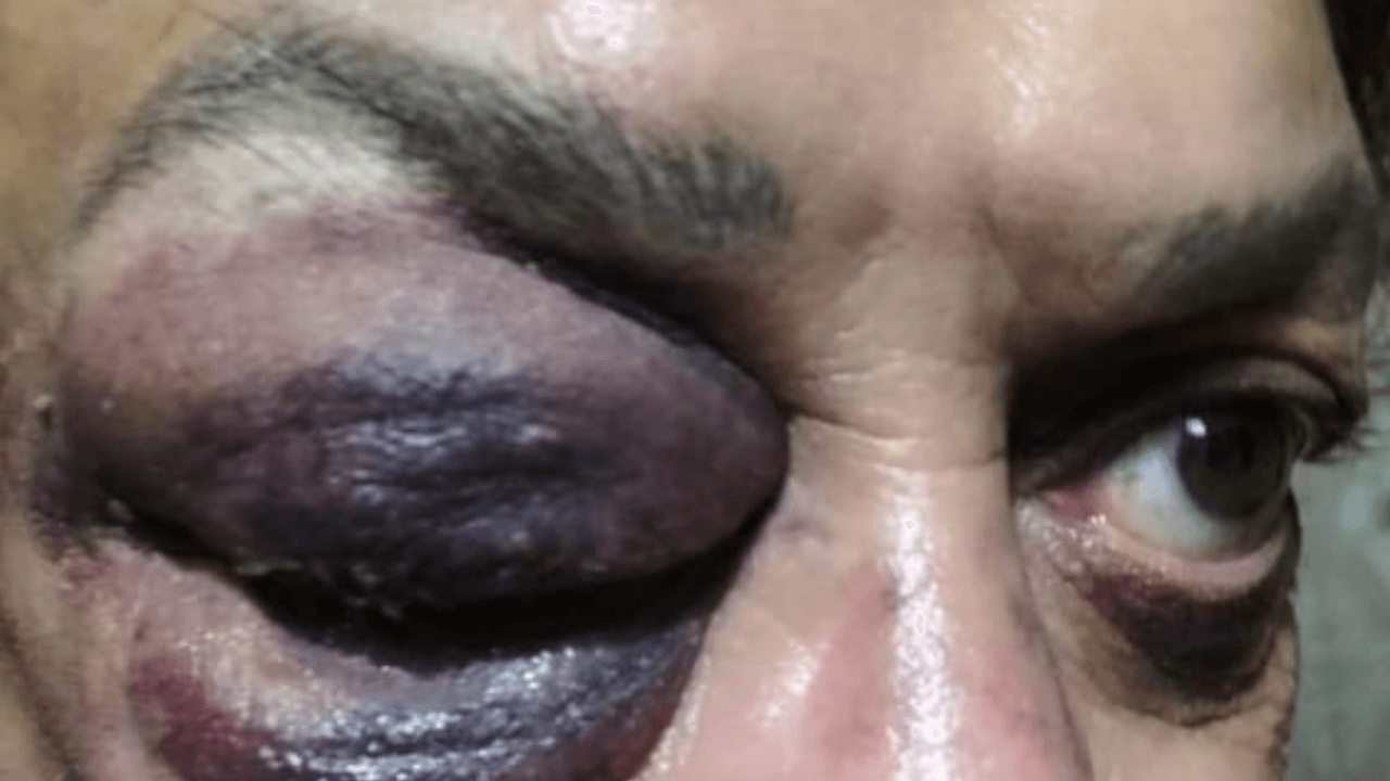 San Giovanni Rotondo, venne picchiato perché gay. Riconosciuta l’aggravante della matrice omofoba, la sentenza - aggressione san giovanni rotondo - Gay.it