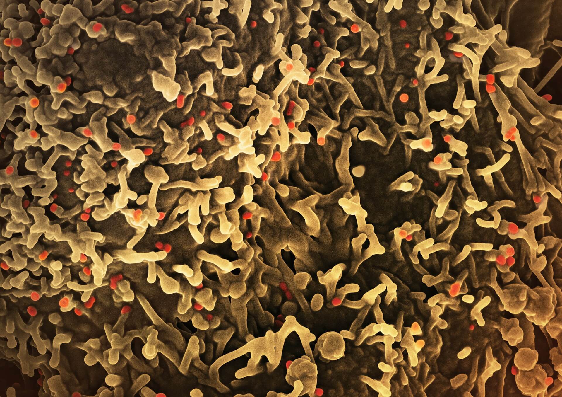 MPOX, monkeypox, significato e definizione