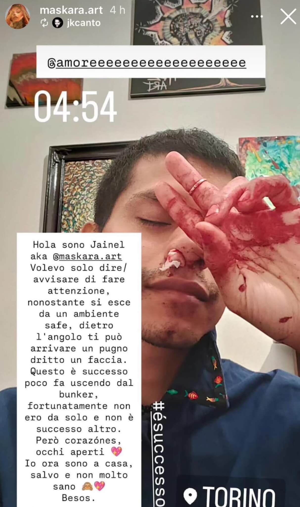 Torino, pugni in faccia ad un ragazzo che passeggiava con il compagno - Jainel King Canto 1 - Gay.it