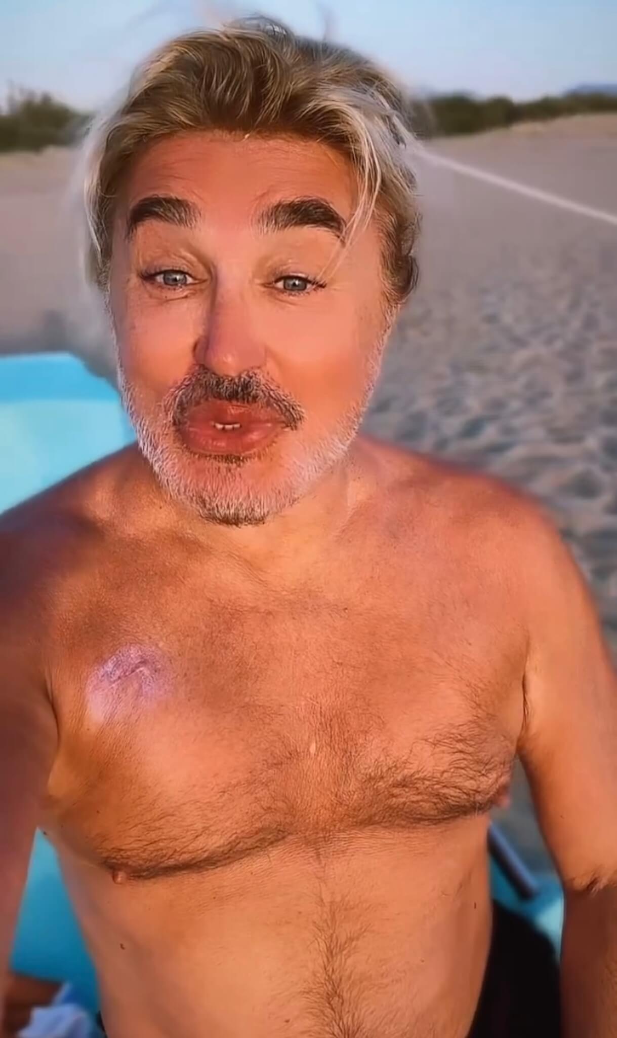 Scialpi
