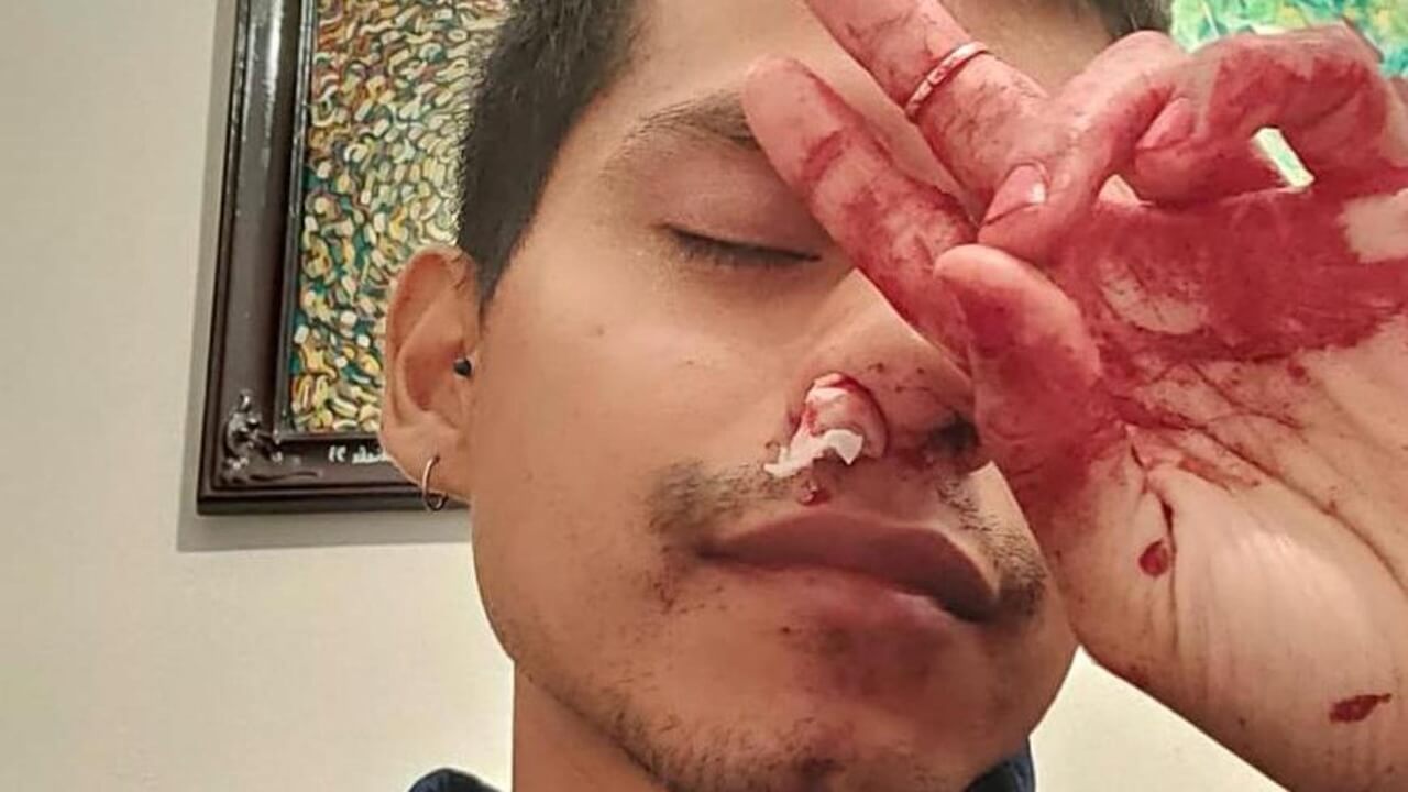 Torino, pugni in faccia ad un ragazzo che passeggiava con il compagno