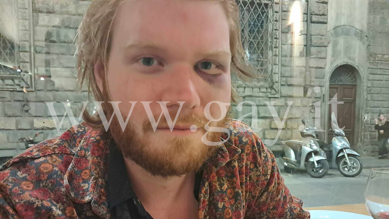Firenze Aggressione Polizia Andrew Niklas Curtis Gay.it