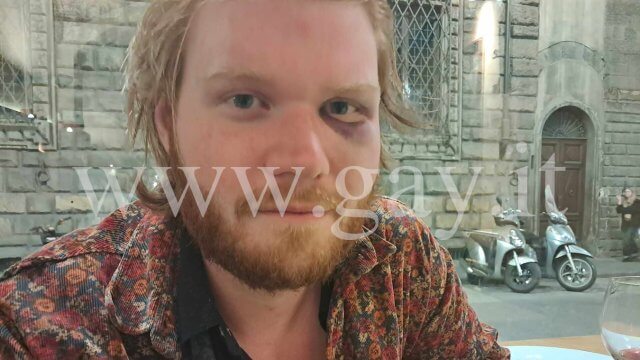 Firenze Aggressione Polizia Andrew Niklas Curtis Gay.it