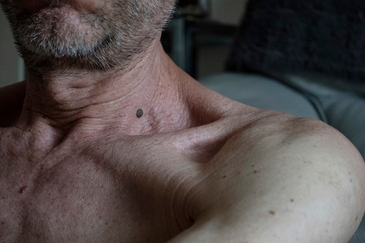 "RI-SCATTI Somebody to love" una mostra fotografica accende i riflettori sulla vita e sulle storie delle persone con Hiv - RI SCATTI. Somebody to love 1 - Gay.it