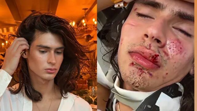Modello picchiato da 15 persone in un McDonald. Calci e insulti omofobi, nessuno ha fatto niente - Sebastian Thomas Robles Lascarro - Gay.it