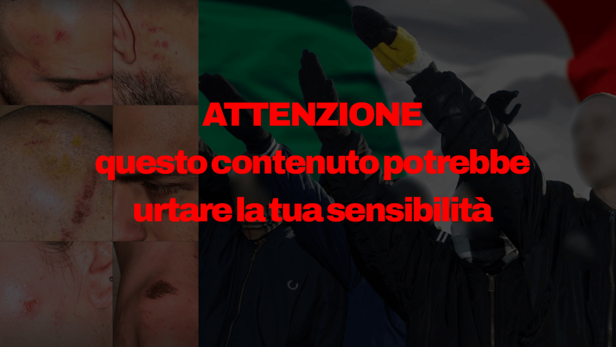 Milano, violento pestaggio a coppia LGBTI, insulti omotransfobici, saluti romani e inni a Hitler a Porta Venezia