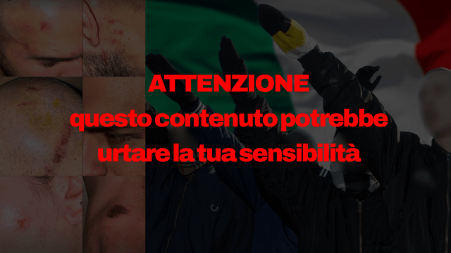 Coppia LGBTI pestata a Milano nel quartiere Porta Venezia la notte tra il 22 e il 23 Novembre: saluti romani e apologia di Hitler, gli aggressori erano italiani.