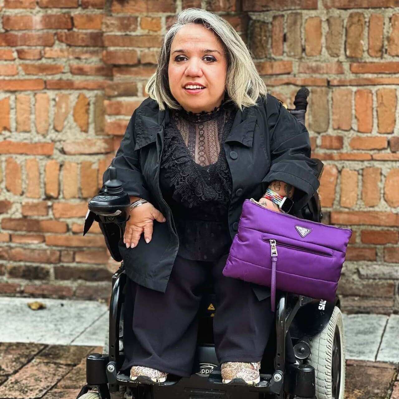 valentina tomirotti, displasia diastrofica