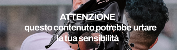 Roma coppia gay aggredita con acido
