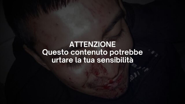roma-aggressione-omofoba-capodanno (2)