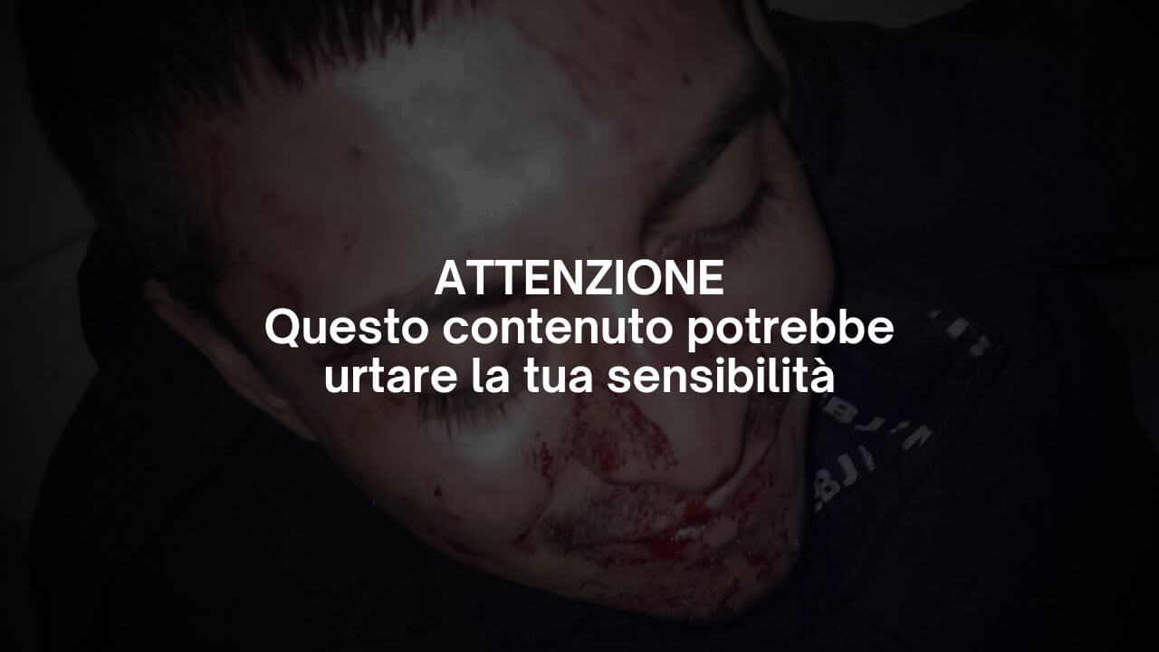 Roma, terrificante aggressione omofoba nella notte di Capodanno: in 10 contro 2 al grido di “Fr*ci di m*rda”