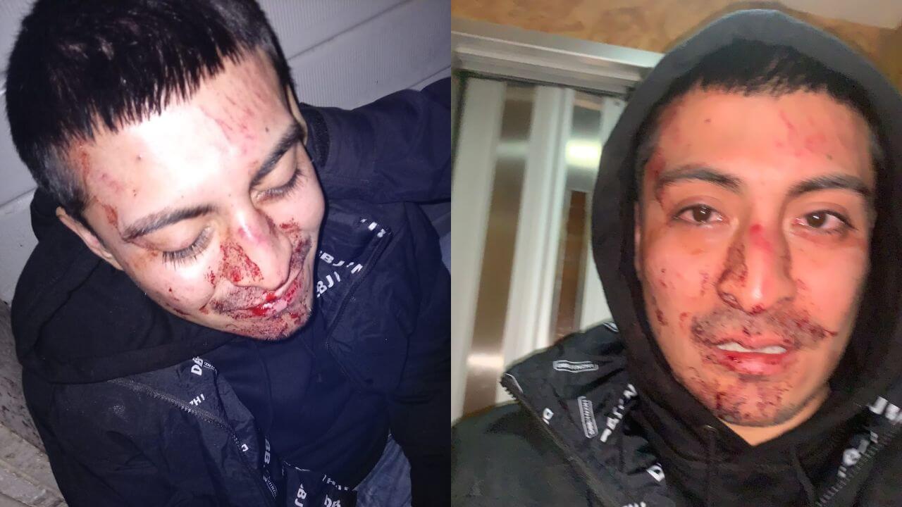 roma-aggressione-omofoba-capodanno (2)