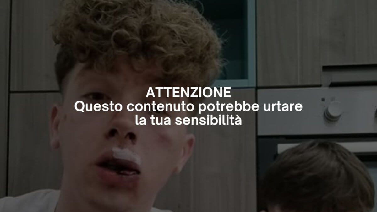 Torino, violenza fuori da una disco gay contro un creator di OnlyFans nella notte di Capodanno