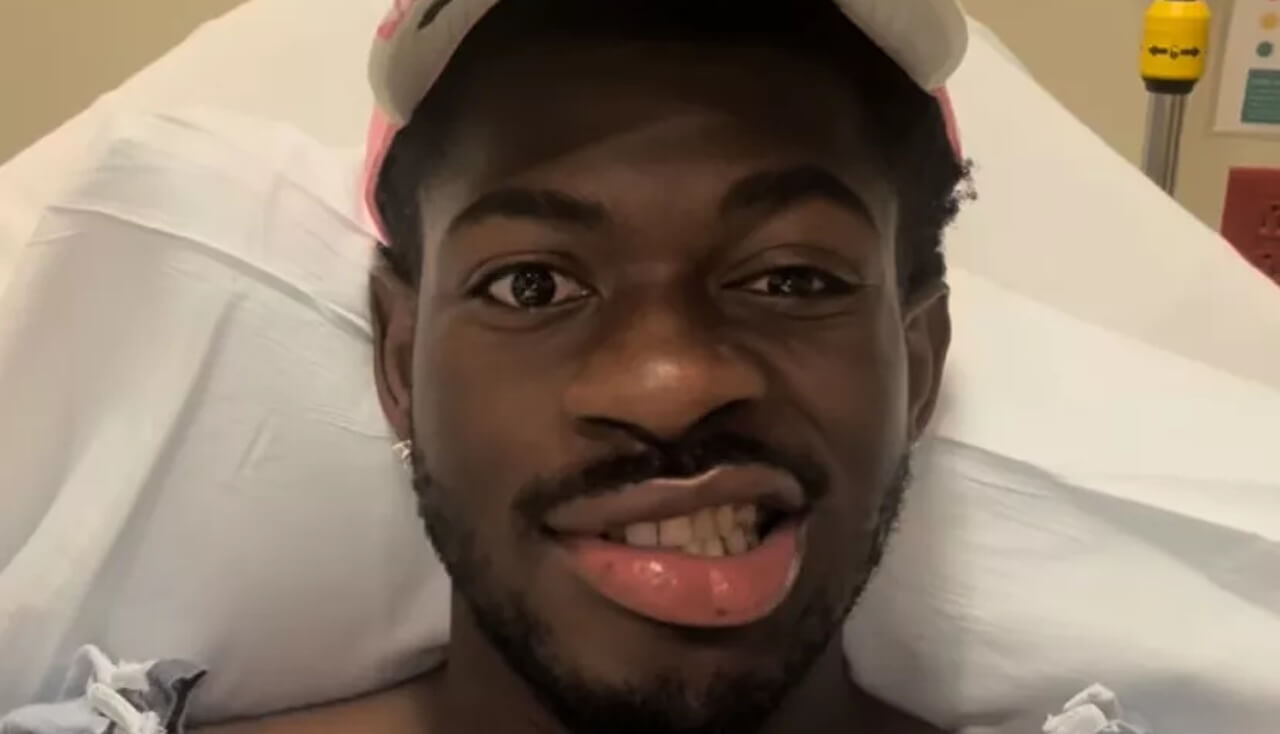 Lil Nas X arrestato dopo aver aggredito un agente: nuovo ricovero in ospedale, cosa è successo - Lil Nas X paralisi facciale - Gay.it