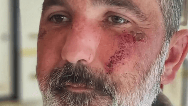 Francesco Sorgon, 42enne di Cavaso del Tomba (TV), è stato vittima di una violenta aggressione omofoba sabato 17 maggio, nei pressi del supermercato Crai della cittadina in provincia di Treviso.