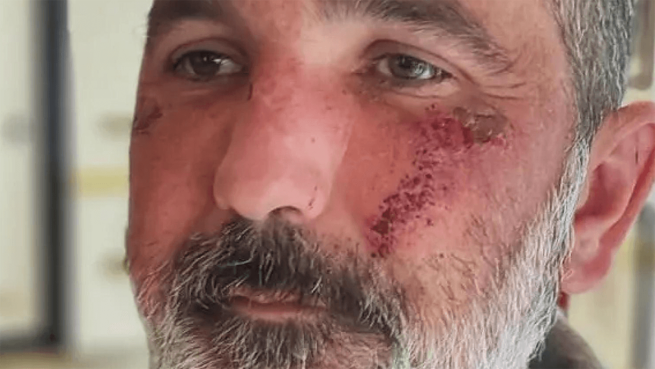 “Mi hanno adescato e poi picchiato perché sono gay”, aggressione omofobica a Cavaso del Tomba (TV)