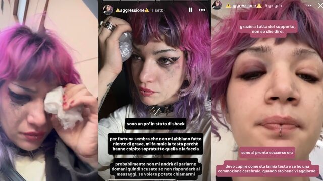 Roma, l'attivista queer Luna Hadley interviene per difendere una ragazza e viene massacrata di botte - Luna Hadley pestaggio a Centocelle - Gay.it