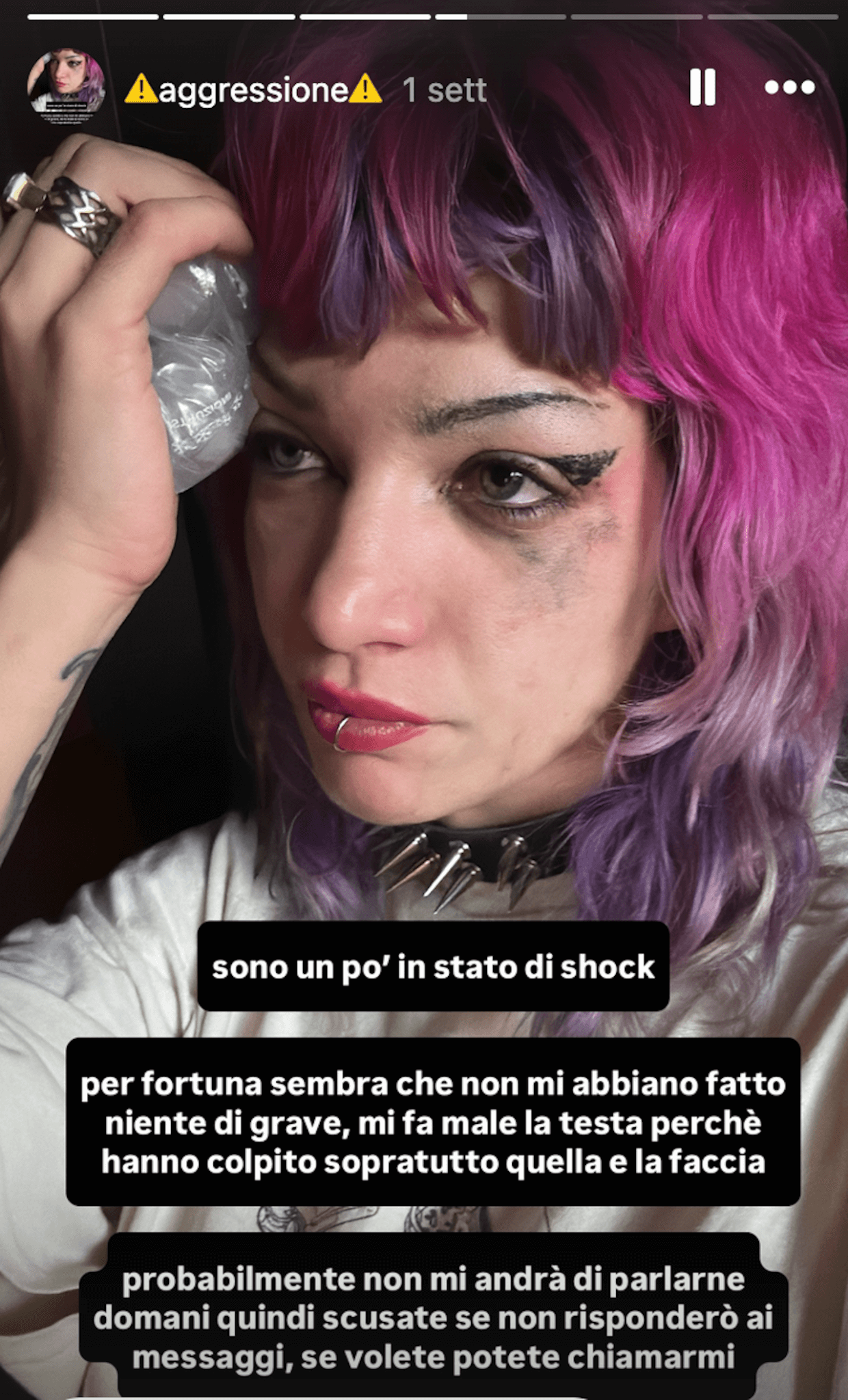 Roma, l'attivista queer Luna Hadley interviene per difendere una ragazza e viene massacrata di botte - Luna Hadley - Gay.it