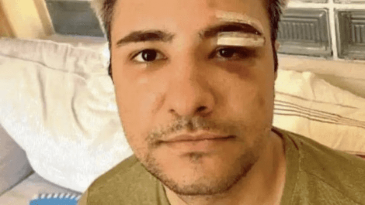 Roma, aggressione omofoba ad Alessandro Ansaldo: tre minorenni ai domiciliari. Il Gip: “Mera sopraffazione e umiliazione della vittima”