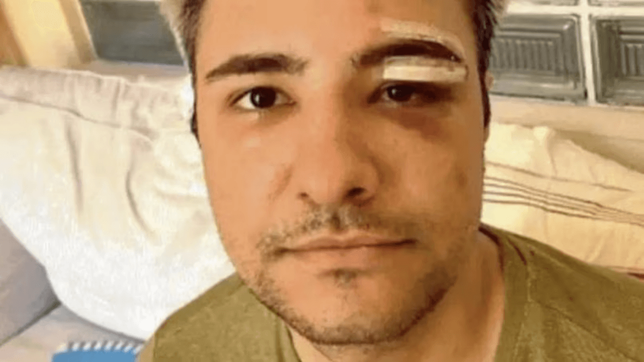 Aggressione omofoba a Roma, ai danni di Alessandro Ansaldo