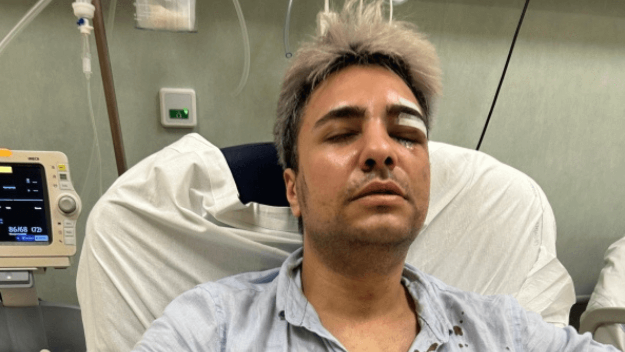 Alessandro Ansaldo, 25enne vittima di un'aggressione omofoba a Roma - Foto Corriere della Sera