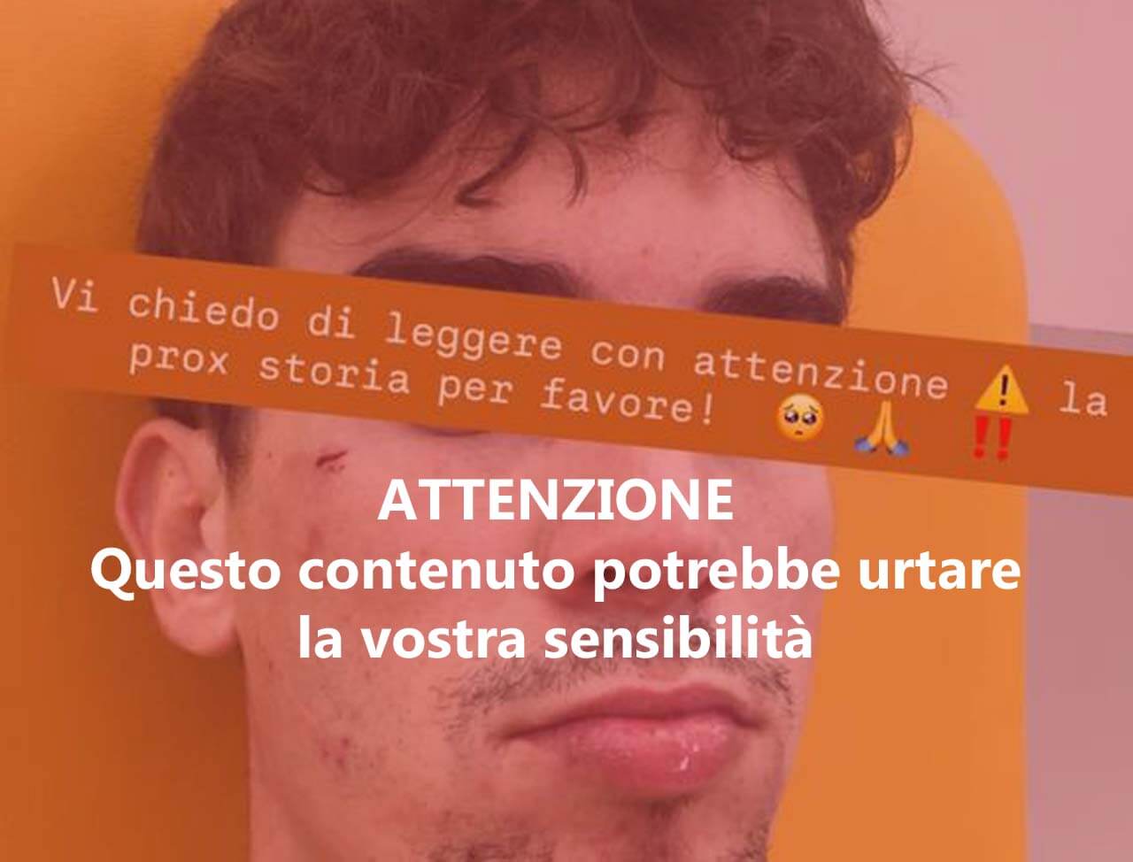 Parma, aggressione omofoba davanti alla stazione: “Fr*cia di m*rda”. 24enne picchiato a sangue, “Nessuno è intervenuto”