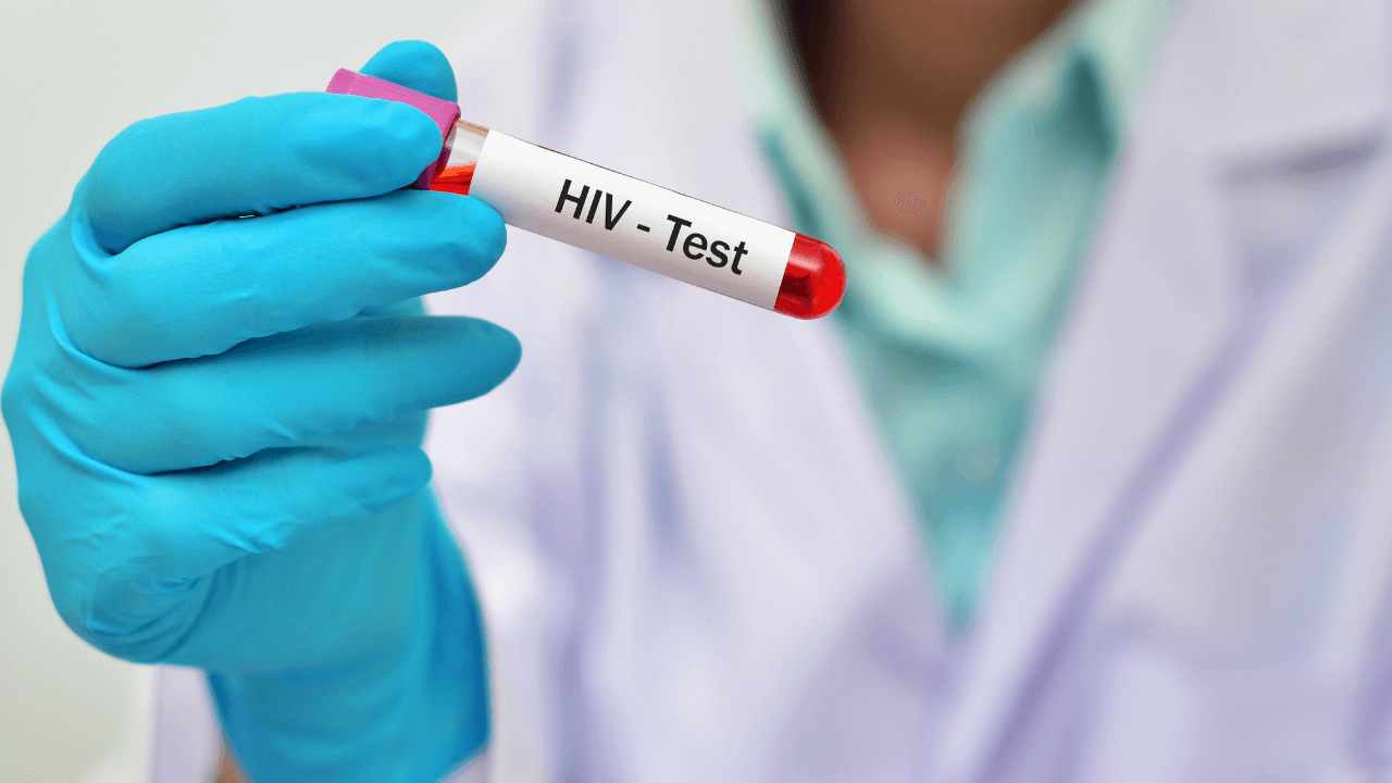 HIV, uomo guarito dopo trapianto di cellule staminali: il settimo caso al mondo riscrive le regole della cura - hiv3 - Gay.it