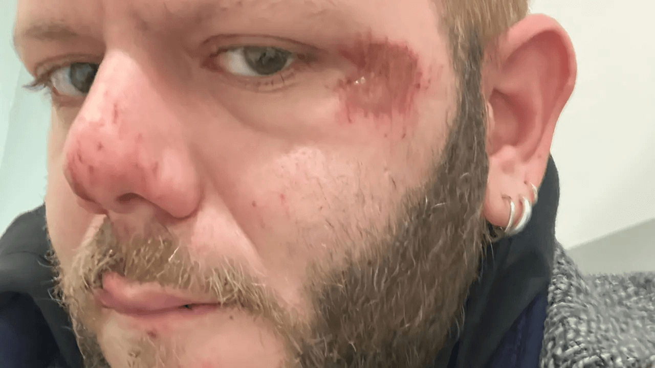 Francesco Cavicchioli, 40enne aggredito, rapinato e insultato a Modena
