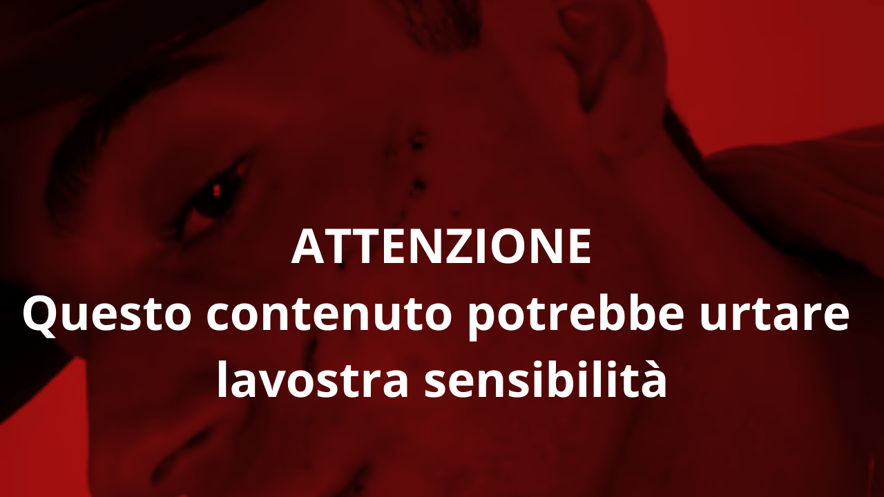 Genova, aggressione omofoba: 19enne sfregiato con un coltellino. “Mi dicevano ‘fr*cio di m*rda, muori”, il racconto di Domenico