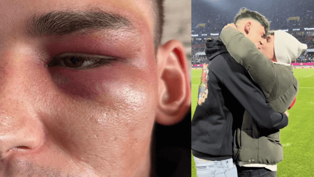 A sinistra il volto di Pascal Kaiser tumefatto dopo l'aggressione omofobica (foto SimilQueer). A destra la proposta di matrimonio al suo compagno Moritz di una settimana fa.