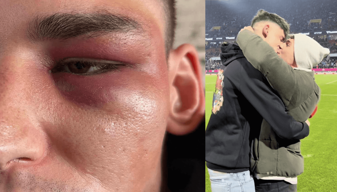 Pascal Kaiser, l’arbitro aggredito perché gay soffre di Disturbo Post-Traumatico da Stress: “È un periodo molto difficile”