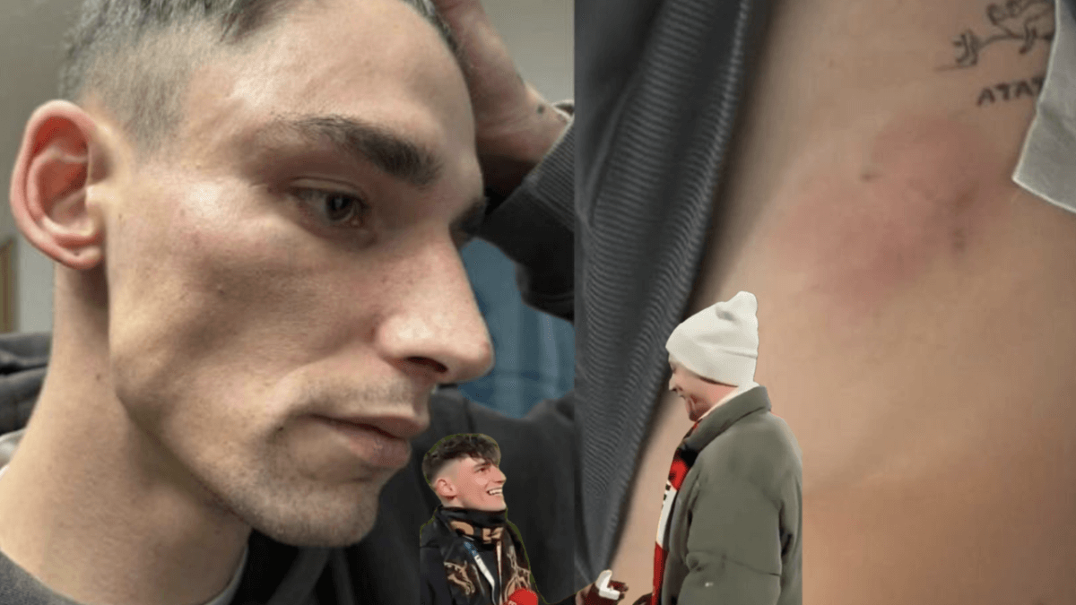 Pascal Kaiser, aggredito una seconda volta l’arbitro che aveva chiesto la mano al fidanzato