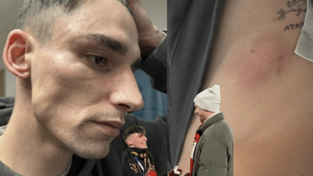 Pascal Kaiser, aggredito una seconda volta l'arbitro che aveva chiesto la mano al fidanzato - Pascal Kaiser nuova aggressione omofoba - Gay.it