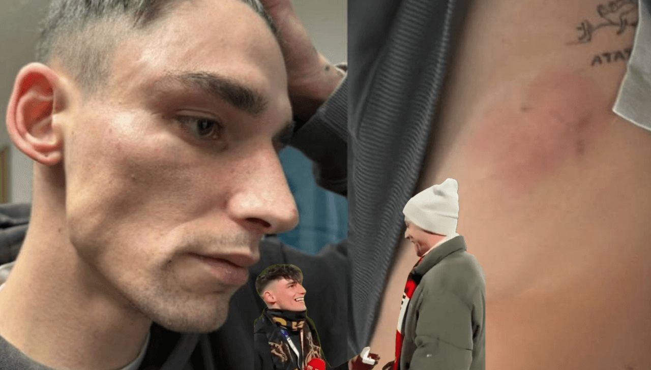 Pascal Kaiser, l'arbitro aggredito perché gay soffre di Disturbo Post-Traumatico da Stress: "È un periodo molto difficile" - Pascal Kaiser nuova aggressione omofoba - Gay.it