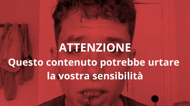 Joe De La Torre, creator di OnlyFans aggredito e insultato
